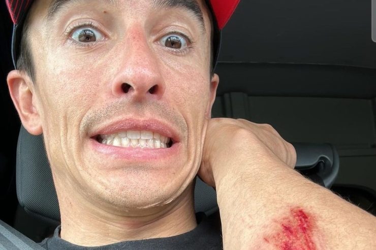 Tifosi in allarme dopo il nuovo incidente occorso a Marquez: la situazione
