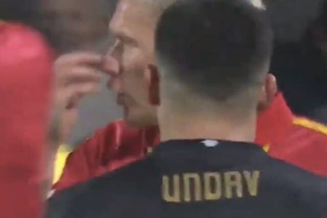 Edvardsen prende in giro Stiller per il suo naso