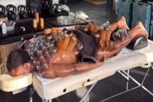 Openda si sottopone alla “coppettazione”